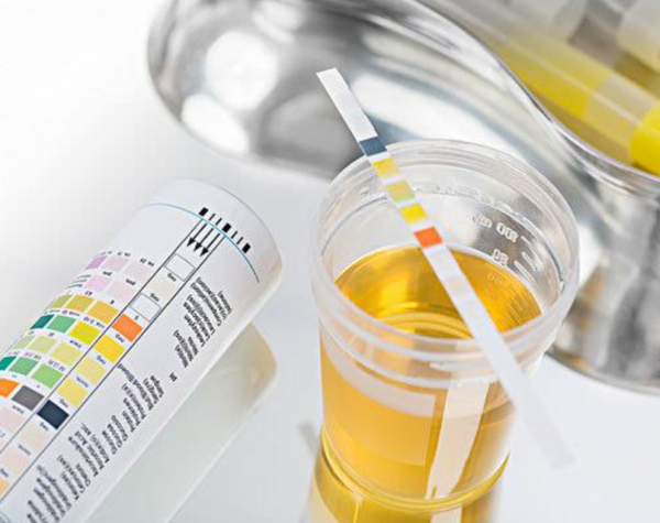 腎病怎麼避免成為尿毒症？做好2個指標檢測，早發現早治療很重要