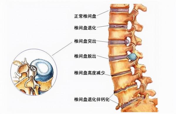 “無效治療”是存在的,醫生:很多手術或無需做,很多藥或不用吃 “無效治療”是存在的,醫生:很多手術或無需做,很多藥或不用吃