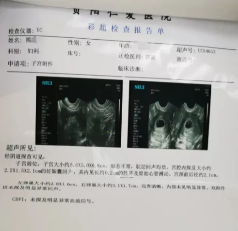 在美容院HPV檢測陽性,貴陽女子選擇流產,結果卻發現測錯了? 在美容院HPV檢測陽性,貴陽女子選擇流產,結果卻發現測錯了?