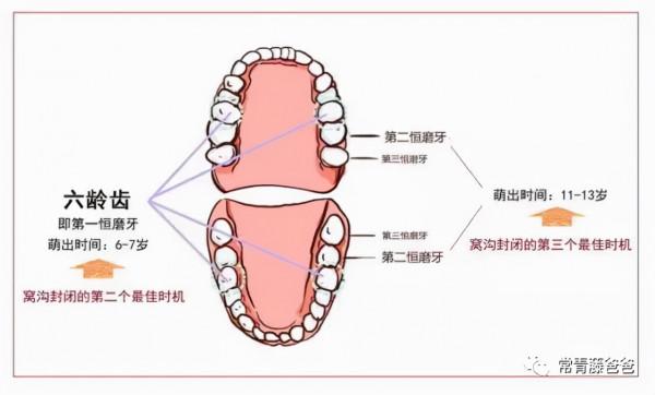 6-12歲換牙時間和換牙期問題大盤點！孩子一口好牙關鍵就在這幾點