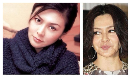 6位女星步入不惑之年,面容垮掉,膠原蛋白流失,彷彿整容失敗 6位女星步入不惑之年,面容垮掉,膠原蛋白流失,彷彿整容失敗