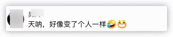 本山傳媒嬌嬌自曝整容，曬術後照被指認不出，多次割眼皮腫脹明顯