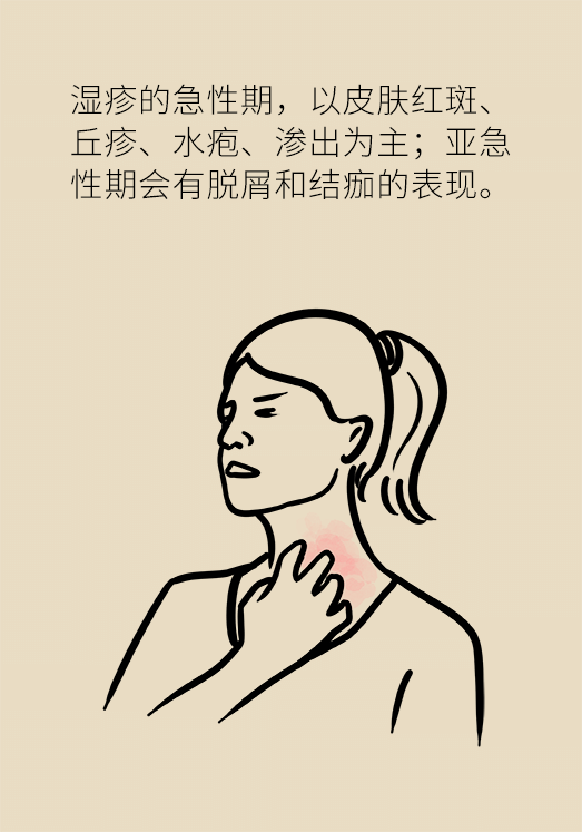 一到夏天癢癢癢!溼疹反反覆覆,祛溼到底有用嗎? 一到夏天癢癢癢!溼疹反反覆覆,祛溼到底有用嗎?