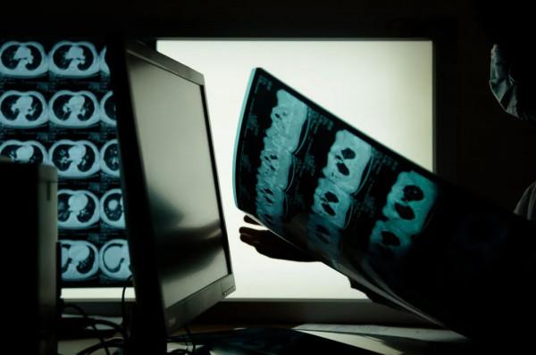 當一位肺癌晚期患者可以多活20個月