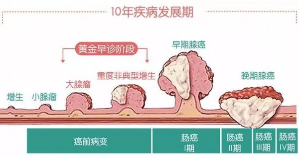 我就是做胃腸鏡檢查，為什麼還要取活檢？