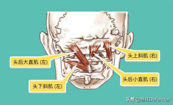 脖子又酸又痛！怎樣緩解頸肩痠痛？這裡有答案