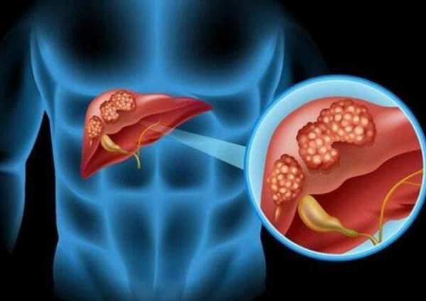 確診到病逝,塗們僅僅堅持了一個月,為何這些癌症發現就是晚期? 確診到病逝,塗們僅僅堅持了一個月,為何這些癌症發現就是晚期?