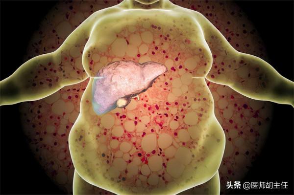 10歲女孩吃出重度肝硬化，醫生提醒：3個壞習慣一定要戒除
