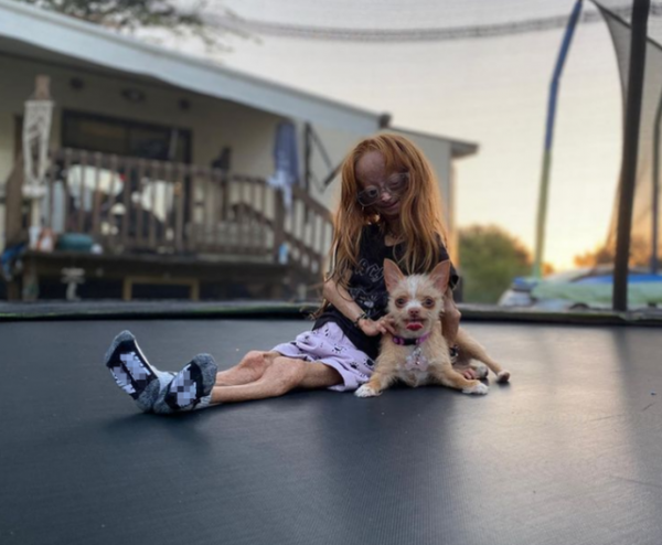 知名網紅阿達莉亞·羅斯因早衰症去世，年僅15歲，家人公佈死訊