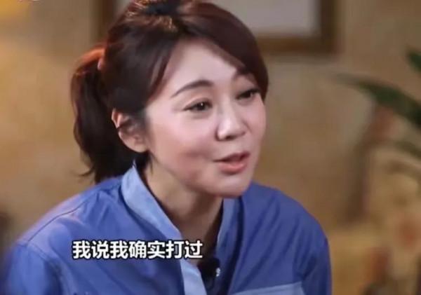 整容臉充斥電視劇，臉部僵硬，下巴像錐子，個個不能細看​