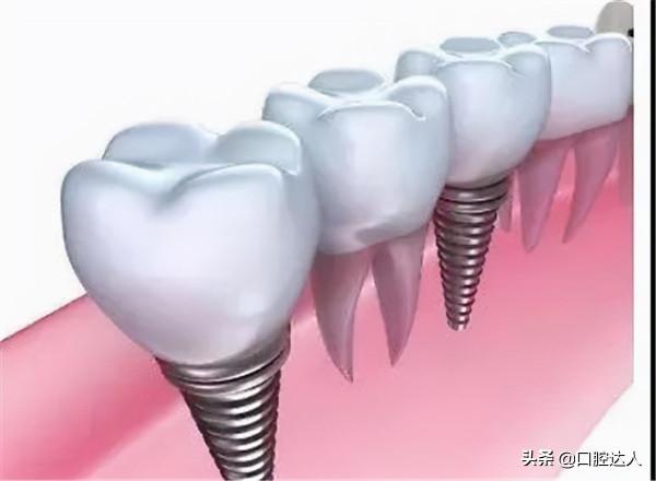 16個實用口腔小常識，一定有你想問的