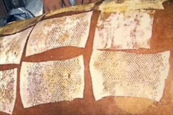 最恐怖的死法：83天的核事故救治，他看著自己一點點腐爛成活死人