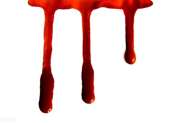 警惕身體的5處異常出血,可能是腫瘤 警惕身體的5處異常出血,可能是腫瘤