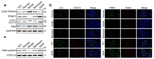 餘仁歡教授團隊膜性腎病“從脾論治”機制研究取得新進展