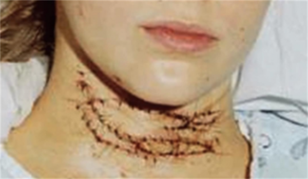 99年美國囚犯被判終身監禁，蠢到親手改判自己死刑，坐上電椅受刑