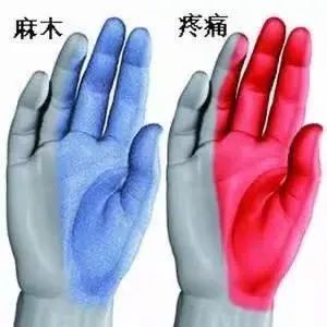 手麻、手痛，熟睡中被“麻醒”？西安醫生提醒：上班族當心