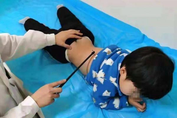 暗香療百病 巧用梅花針&mdash;&mdash;廣安門醫院梅花針專題門診