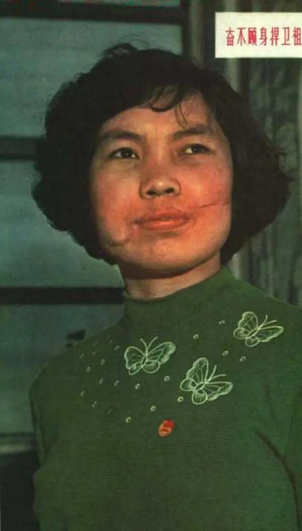 1964年,那個被毛主席接見的“無手”女英雄,後來怎麼樣了? 1964年,那個被毛主席接見的“無手”女英雄,後來怎麼樣了?