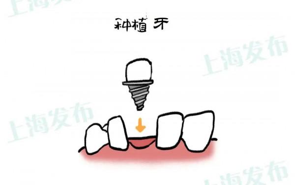 【醫聊】怎麼結束牙疼?被傷害的牙神經有話說 【醫聊】怎麼結束牙疼?被傷害的牙神經有話說