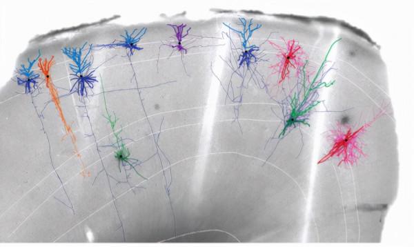 美國“腦計劃”取得重大進展，從小鼠到猴子再到人類
