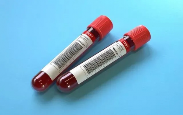 融資超72億！羅氏三連投腫瘤早篩新銳