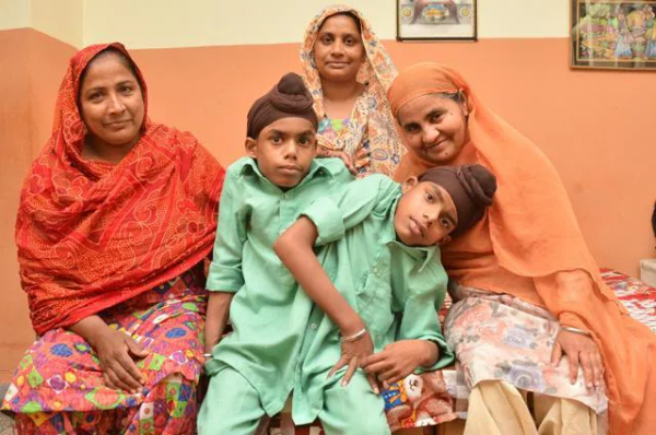 印度連體雙胞胎剛出生就被遺棄，如今一起找到工作，拿雙份工資