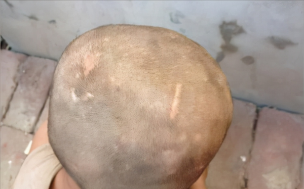 2015年，河南7歲男童被親生父母養豬圈，與豬同吃同住不會人言