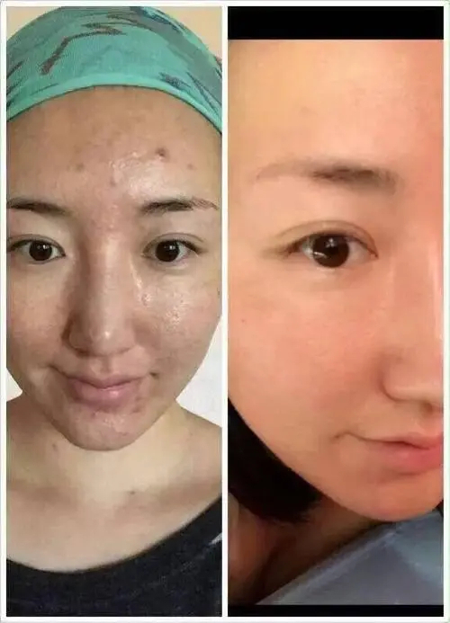 秋冬季護膚小常識 健康護膚小常識大全