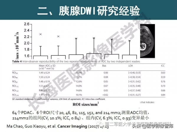 體部DWI共識及胰腺DWI研究經驗介紹