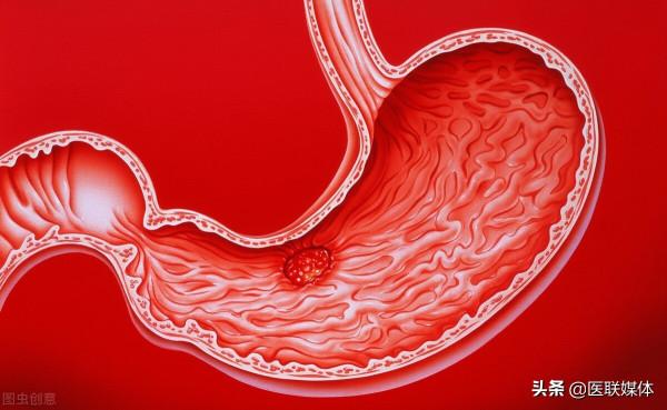 胃病三分靠治，七分靠養？養護腸胃牢記“4不要”