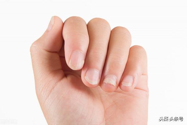 看名醫葉天士如何治療肝陽化風(肝風)三 看名醫葉天士如何治療肝陽化風(肝風)三