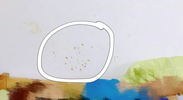 兒子在幼兒園流鼻血,我都急死了,問他卻說“不知道” 兒子在幼兒園流鼻血,我都急死了,問他卻說“不知道”