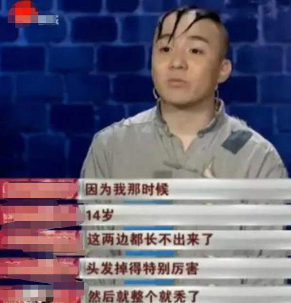 8歲演“三毛”走紅,與孫儷是同班同學,如今的孟智超怎麼樣了? 8歲演“三毛”走紅,與孫儷是同班同學,如今的孟智超怎麼樣了?