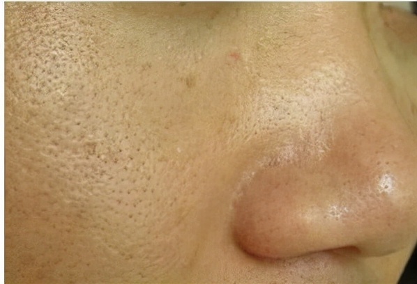 醫生提醒：衰老加速，面部或會出現3個跡象，要引起重視