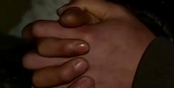 四川19歲女孩患絕症，唯一願望是見生母一面，為何母親拒絕相見？