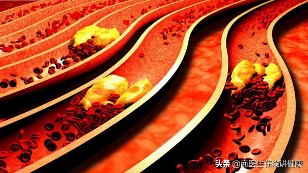 從起病到死亡，得了糖尿病是怎樣一種體驗？