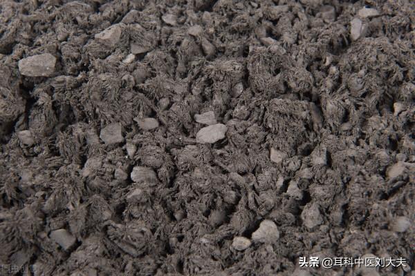 耳鳴、聽力下降、失眠？孫思邈的一張方子，止鳴、升聽、助眠