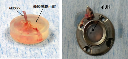 敲黑板！輸液港無損傷針這些知識點，你知道嗎？