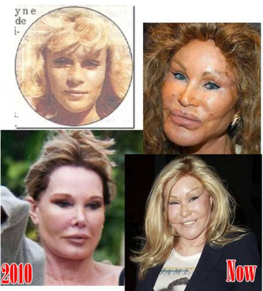 整容富婆“貓女”：離婚獲得25億美元，如今僅靠900美元維持生活