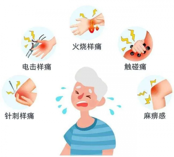 痛得要命！73歲阿姨臉上冒出連串的“北斗七星”，只因病毒深藏不露