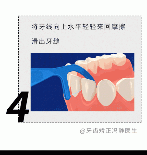 牙縫裡摳出的黃色物質到底是啥?為啥那麼臭 牙縫裡摳出的黃色物質到底是啥?為啥那麼臭