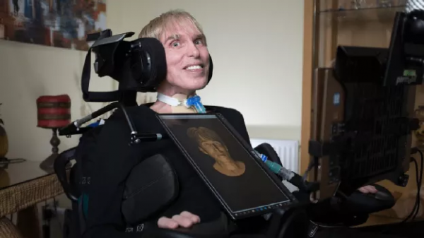 逆天改命，機械飛昇：漸凍症科學家將自己改造成了「半機械人」