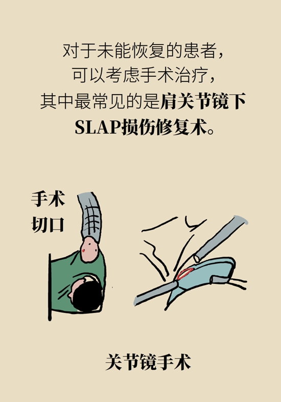 健身房裡最常發生的肩痛，該怎麼應對？