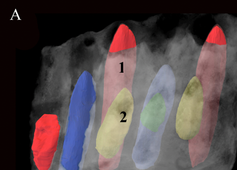 76天就換次牙，竟然是為了吃吃吃