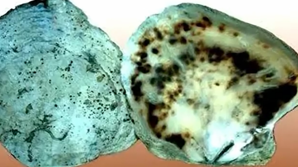 有人長六根手指，有人長兩顆腦袋，但你聽過人的頭上可以長貝殼嗎