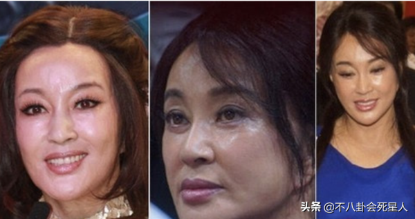 中年女星整容後遺症一堆！臉像鞋拔子，不敢做大表情，演戲沒法看