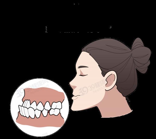 為什麼只要戴牙套,牙齒就可以恢復得很整齊?生動展示矯正過程 為什麼只要戴牙套,牙齒就可以恢復得很整齊?生動展示矯正過程