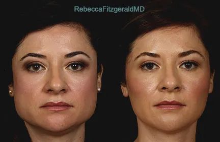 就是它們，一直在偷偷地改變你的臉型