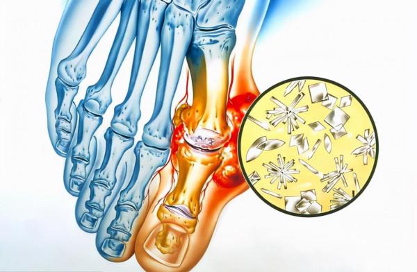豆腐雖好，但是這4類人卻不太適合去吃