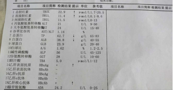 如何看自己肝功能好壞？醫生建議：肝病患者少吃這些